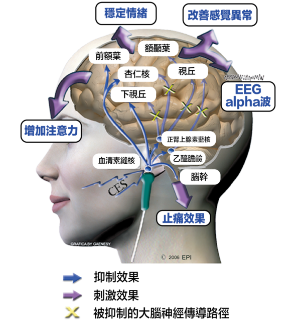 Sapodo腦神經復康儀